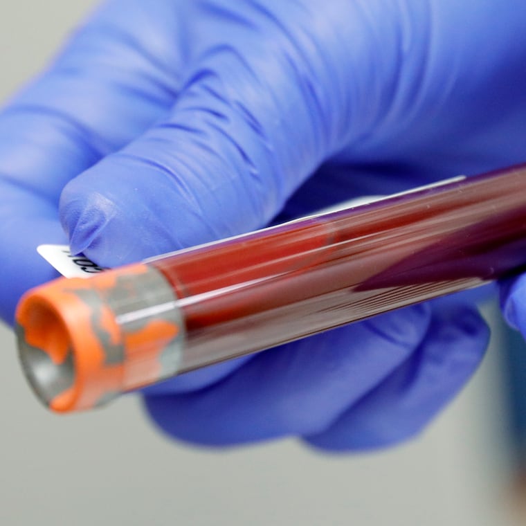 A blood test provided the solution for a teen's on and off vomiting episodes. 